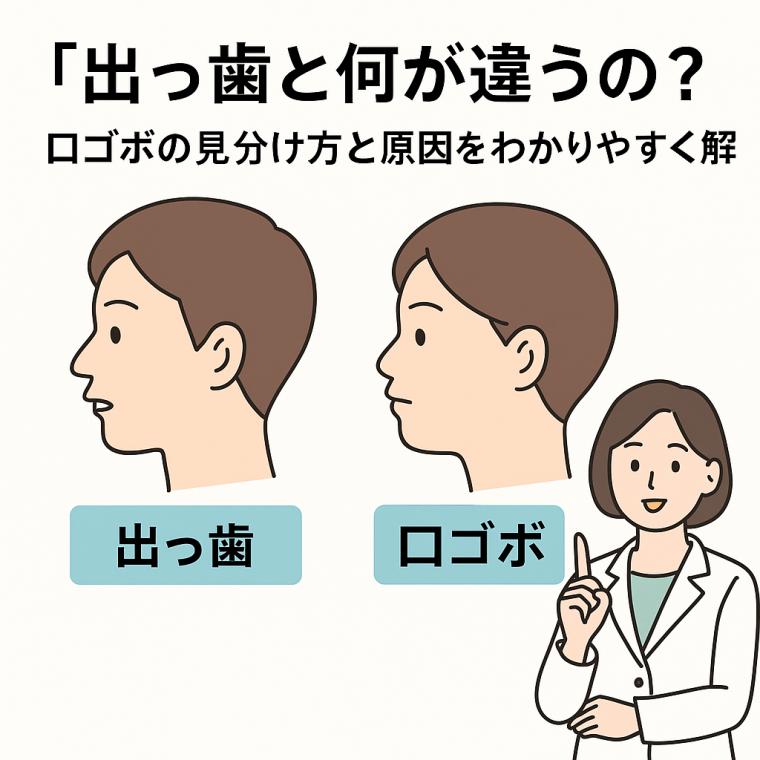 「出っ歯と何が違うの?」口ゴボの見分け方と原因をわかりやすく解説