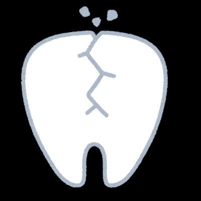 歯がズキズキ！歯根破折による痛みが続くときの対処法