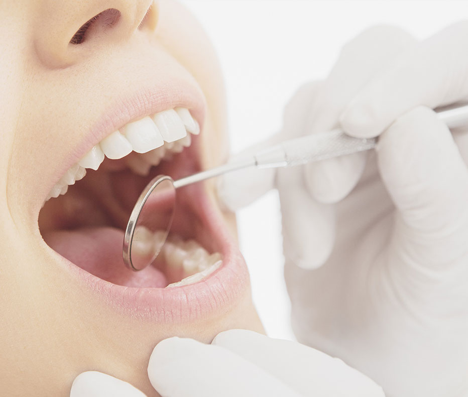 歯の定期検診が重要な理由