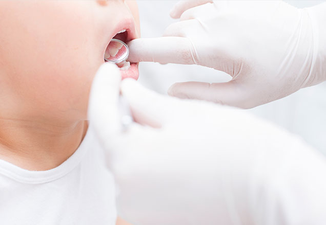 お子さまのお口の発育をチェック！ 保険でできる「口腔機能発達不全症」の検査・治療　